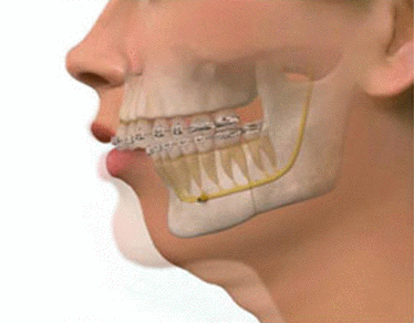 cirugia maxilofacial hospital quiron doctor ruiz villandiego dentista donostia san sebastian urgencias 24 horas